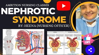 Nephrotic Syndrome  Definition  Types  etiology  Clinical Manifestations  Diagnosis Management [upl. by Ameyn]