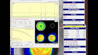 Legacy WAVE  Multifocal Decentered OC 5142014 [upl. by Dash]