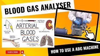 Blood Gas Analyzers  How to use a Blood Gas Analyser [upl. by Krusche99]