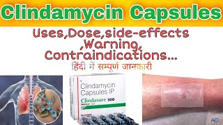 Clindamycin Capsules usesdosagesideeffects  Clindamycin Capsule 300mg  Clindamycin 600mg [upl. by Lehteb485]