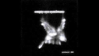 empty eye syndrome slowed [upl. by Anniala583]