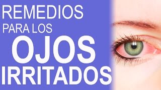 REMEDIOS CASEROS PARA LOS OJOS ROJOS E IRRITADOS  COMO HACER GOTAS PARA LOS OJOS ROJOS [upl. by Anuahsat307]