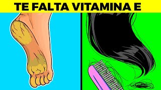 SEÑALES DE QUE TE FALTA VITAMINA E Y NO SABÍAS [upl. by Kannry]