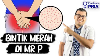 PENYEBAB MUNCIL BINTIK MERAH DI PENIS [upl. by Hough]