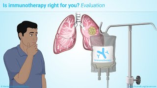 Immunotherapy Treatments for NonSmall Cell Lung Cancer NSCLC [upl. by Tletski]