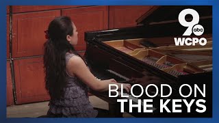 Bloody piano keys Pianist says it doesnt hurt actually [upl. by Esorrebma]