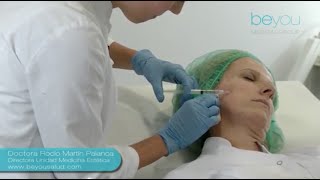 Mesoterapia Facial Tratamiento de medicina estética [upl. by Bast115]