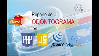 MODULO DE REPORTE DE ODONTOGRAMA ENTREGA 1 [upl. by Irodim]