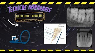 Técnicas radiográficas Intraorais Periapical Interproximal Oclusal [upl. by Del]