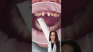 Dr Yazdan for OptiBond 360 [upl. by Ilojne]