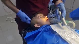 Pediatric Anesthesia in 6years old induction intubation anesthesia [upl. by Akcimat]