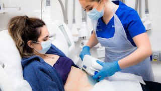 Fat Freezing  What to Expect From a CoolSculpting Treatment [upl. by Bertie]