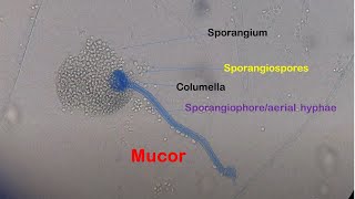 Mucor under the Microscope [upl. by Landri]