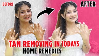 Remove Tan at HOME In Just 1 WEEK 😱  HOME REMEDY [upl. by Robaina]