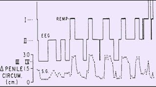 Tecniche psicofisiologiche 3 [upl. by Leind]