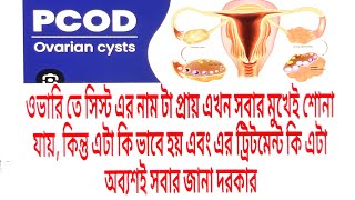 Discussion of PCOD ampPCOSডিম্বাসয় বা ওভারি তে সিস্টcausesHomeopathy Treatment how to prevent [upl. by Ailyn]