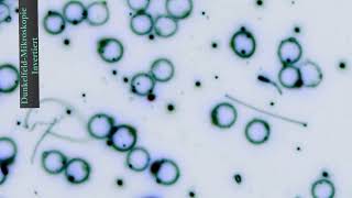 Blutmikroskopie – Tiefe Einblicke Dunkelfeldmikroskopie mit invertierten Bildern 🔬🔬🔬 [upl. by Ekez]