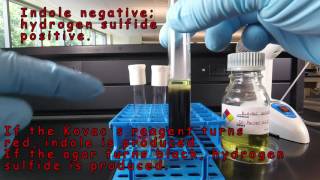 SIM Medium Detection of Indole and Hydrogen Sulfide Production [upl. by Ajssatan841]