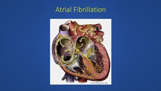 Normal Skipped or Irregular Heart Beats [upl. by Halimeda]